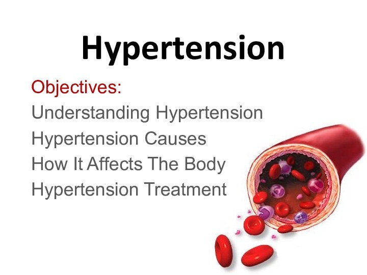 HypertensionObjectives:Understanding HypertensionHypertension CausesHow It Affects The BodyHypertension Treatment