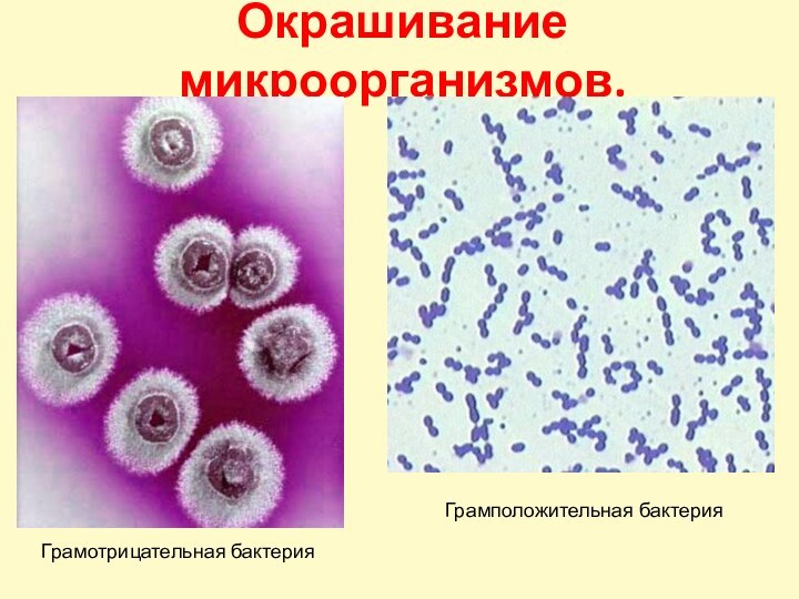Окрашивание микроорганизмов.Грамотрицательная бактерияГрамположительная бактерия