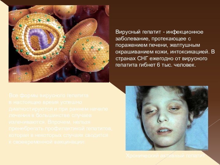 Вирусный гепатит - инфекционное заболевание, протекающее с поражением печени, желтушным окрашиванием кожи,