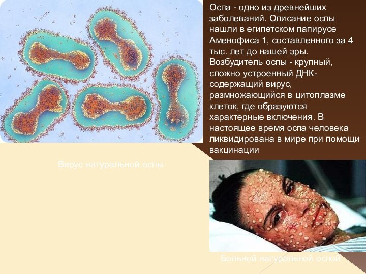Вирус натуральной оспы Больной натуральной оспойОспа - одно из древнейших заболеваний.
