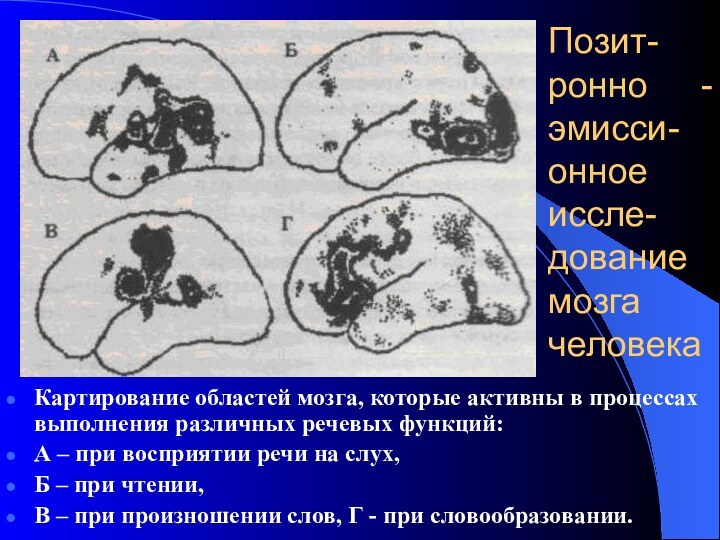 Позит- ронно -  эмисси- онное иссле- дование мозга человекаКартирование областей мозга,