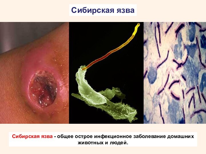 Сибирская язваСибирская язва - общее острое инфекционное заболевание домашних животных и людей.