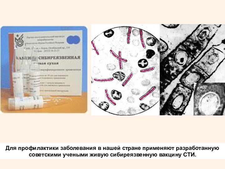 Для профилактики заболевания в нашей стране применяют разработанную советскими учеными живую сибиреязвенную вакцину СТИ.