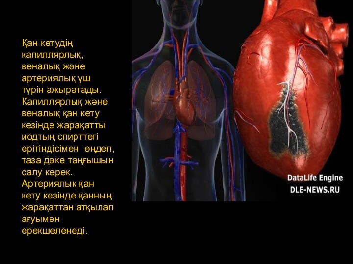 Қан кетудің капиллярлық, веналық және артериялық үш түрін ажыратады. Капиллярлық және веналық қан кету