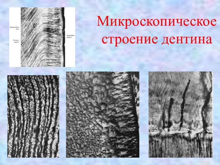 Микроскопическое строение дентина