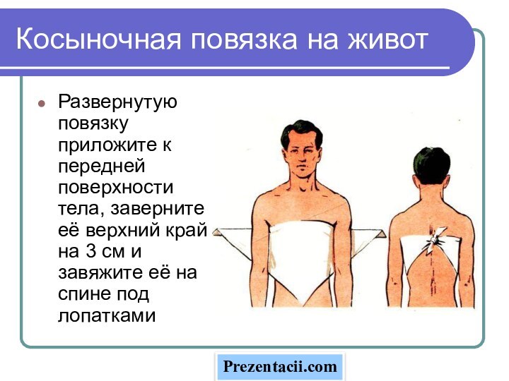 Косыночная повязка на животРазвернутую повязку приложите к передней поверхности тела, заверните её