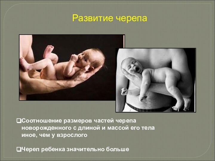Развитие черепаСоотношение размеров частей черепа новорожденного с длиной и массой его тела
