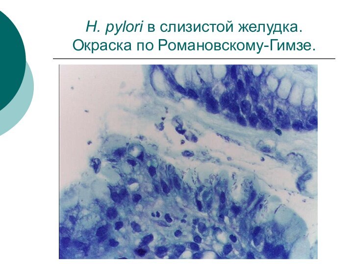 H. pylori в слизистой желудка. Окраска по Романовскому-Гимзе.