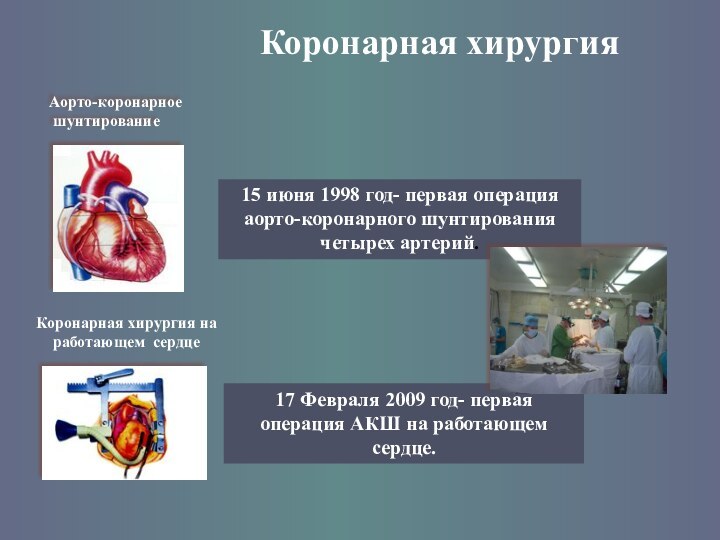 Коронарная хирургияКоронарная хирургия на работающем сердцеАорто-коронарное шунтированиеАппарат искусственного кровообращения15 июня 1998 год-