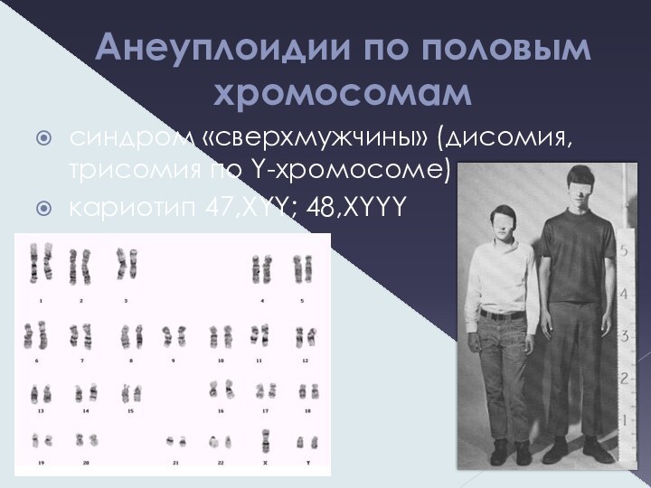 Анеуплоидии по половым хромосомамсиндром «сверхмужчины» (дисомия, трисомия по Y-хромосоме)кариотип 47,XYY; 48,XYYY