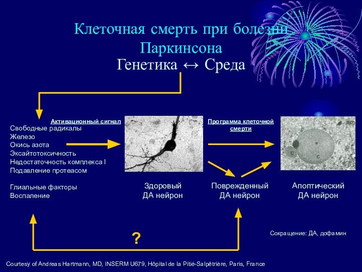 Клеточная смерть при болезни ПаркинсонаАпоптическийДА нейронЗдоровыйДА нейронПрограмма клеточнойсмертиСвободные радикалыЖелезоОкись азотаЭксайтотоксичностьНедостаточность комплекса IПодавление