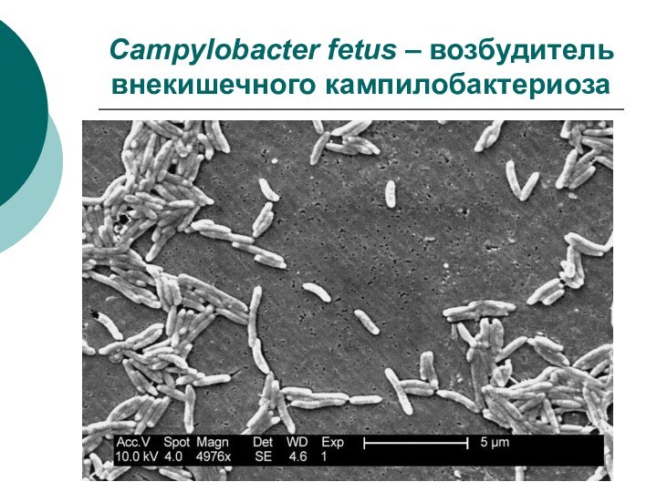 Доклад: Кампилобактериоз