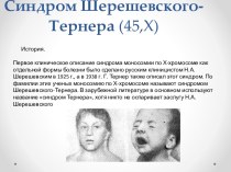 Синдром Шерешевского-Тернера (45,Х)