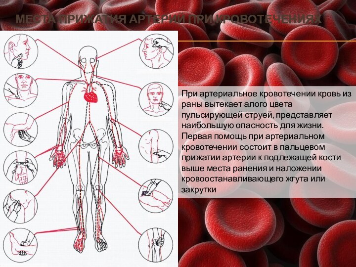 Места прижатия артерий при кровотеченияхПри артериальное кровотечении кровь из раны вытекает алого