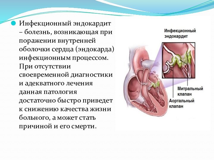 Инфекционный эндокардит – болезнь, возникающая при поражении внутренней оболочки сердца (эндокарда) инфекционным