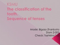 The Сlassification of the tooth.sequence of tenses