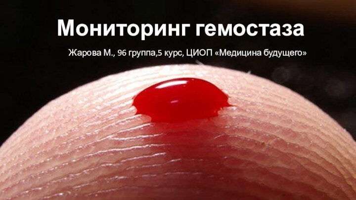 Мониторинг гемостазаЖарова М., 96 группа,5 курс, ЦИОП «Медицина будущего»