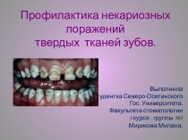 Профилактика некариозных поражений твердых  тканей зубов.