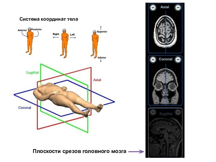 Система координат телаПлоскости срезов головного мозга