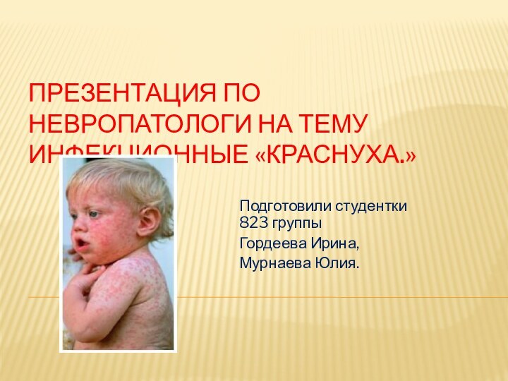 Презентация по невропатологи на тему инфекционные «краснуха.»Подготовили студентки 823 группы Гордеева Ирина,Мурнаева Юлия.