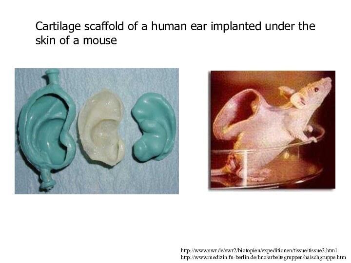 http://www.swr.de/swr2/biotopien/expeditionen/tissue/tissue3.htmlhttp://www.medizin.fu-berlin.de/hno/arbeitsgruppen/haischgruppe.htmCartilage scaffold of a human ear implanted under the skin of a mouse