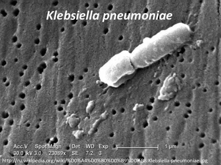 Klebsiella pneumoniae http://ru.wikipedia.org/wiki/%D0%A4%D0%B0%D0%B9%D0%BB:Klebsiella-pneumoniae.jpg