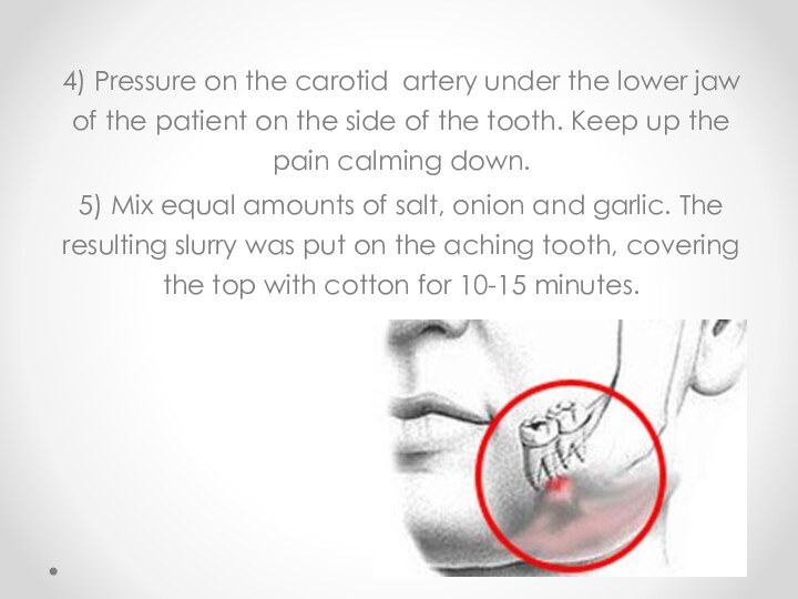 4) Pressure on the carotid artery under the lower jaw of