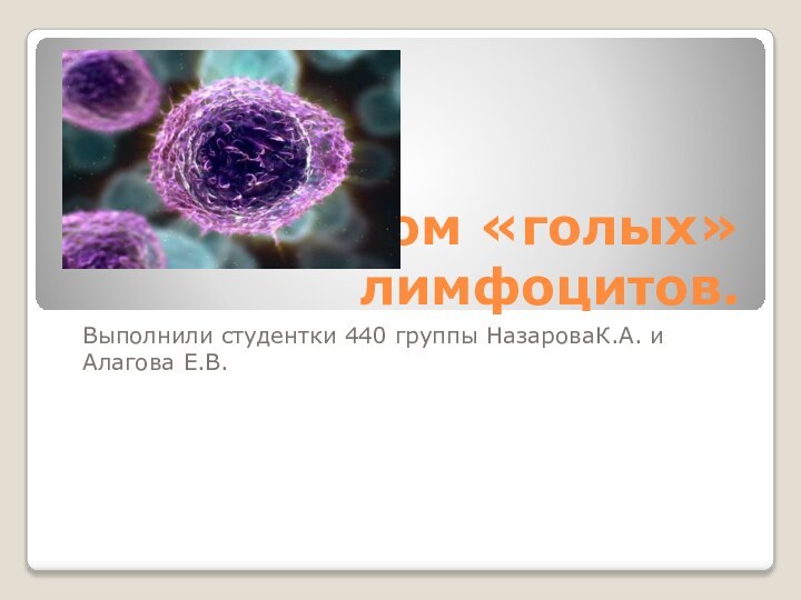 Синдром «голых»лимфоцитов.Выполнили студентки 440 группы НазароваК.А. и Алагова Е.В.
