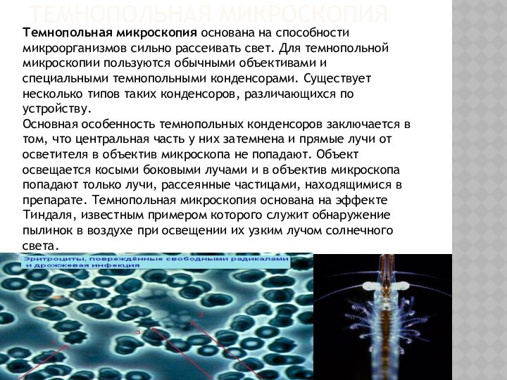 Темнопольная микроскопия   Темнопольная микроскопия основана на способности микроорганизмов сильно рассеивать свет.