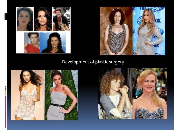 Development of plastic surgery