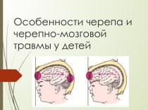 Особенности черепа и черепно-мозговой травмы у детей
