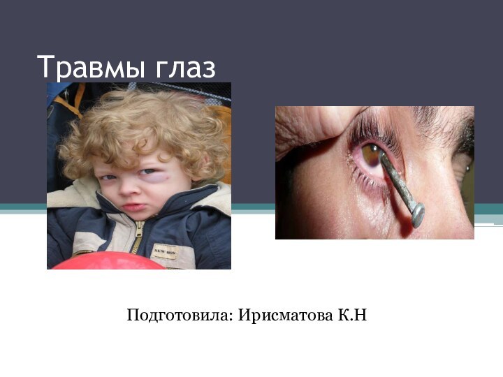 Травмы глазПодготовила: Ирисматова К.Н