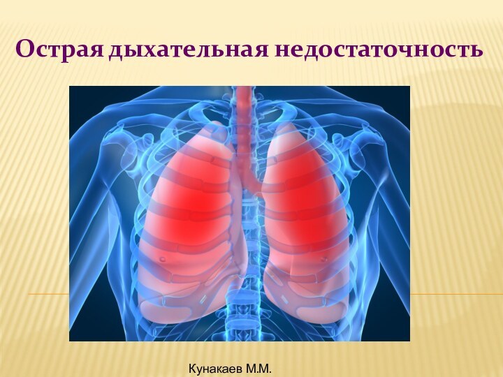 Острая дыхательная недостаточностьКунакаев М.М. 2016