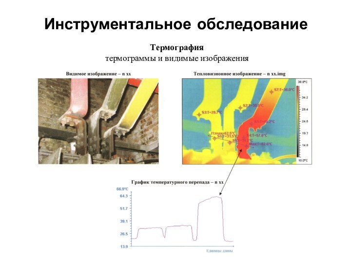 Инструментальное обследованиеТермография термограммы и видимые изображения