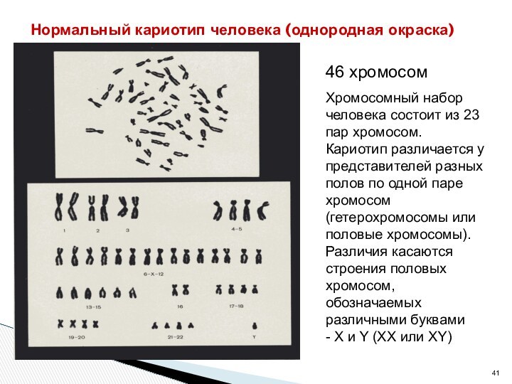Нормальный кариотип человека (однородная окраска)46 хромосомХромосомный набор человека состоит из 23 пар