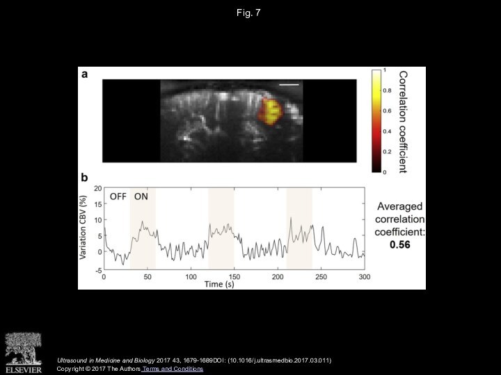 Fig. 7 Ultrasound in Medicine and Biology 2017 43, 1679-1689DOI: (10.1016/j.ultrasmedbio.2017.03.011) Copyright © 2017