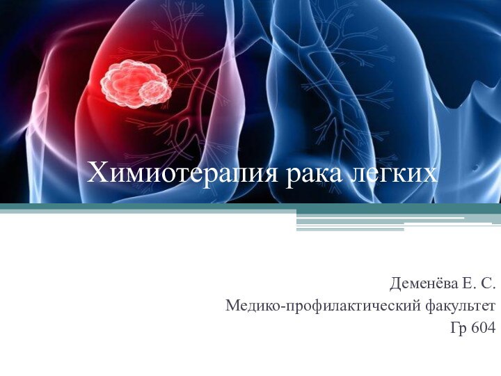 Химиотерапия рака легкихДеменёва Е. С. Медико-профилактический факультет Гр 604