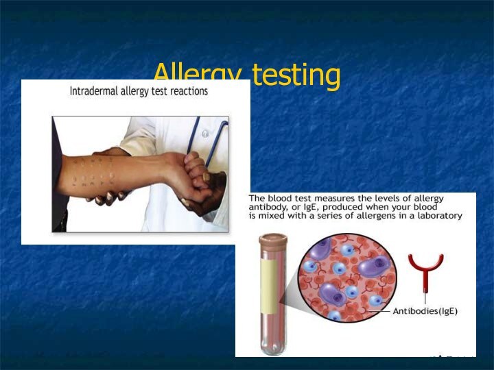 Allergy testing