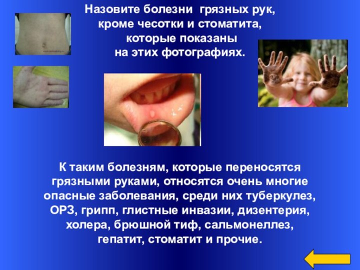 Назовите болезни грязных рук, кроме чесотки и стоматита, которые показанына этих фотографиях.