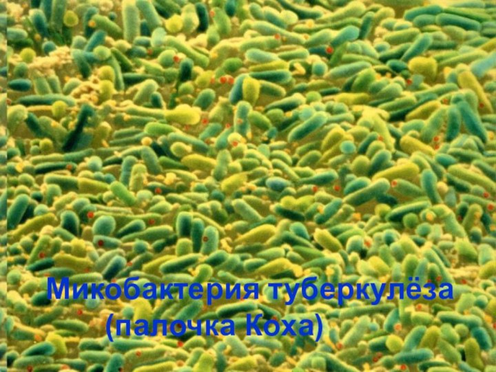 Микобактерия туберкулёза    (палочка Коха)