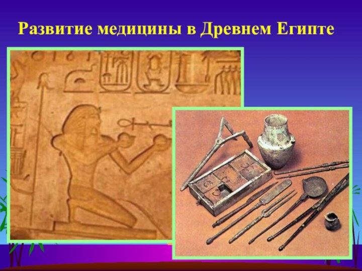 Развитие медицины в Древнем Египте