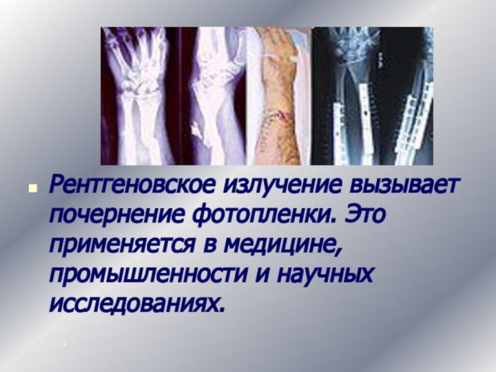 Рентгеновское излучение вызывает почернение фотопленки. Это применяется в медицине, промышленности и научных исследованиях. *