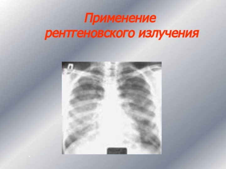 Применение  рентгеновского излучения*
