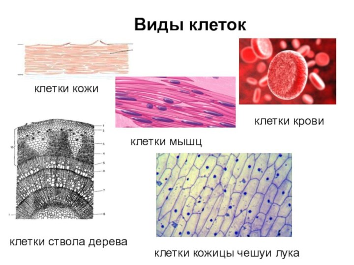 Виды клеток  клетки кожиклетки мышцклетки кровиклетки ствола дереваклетки кожицы чешуи лука