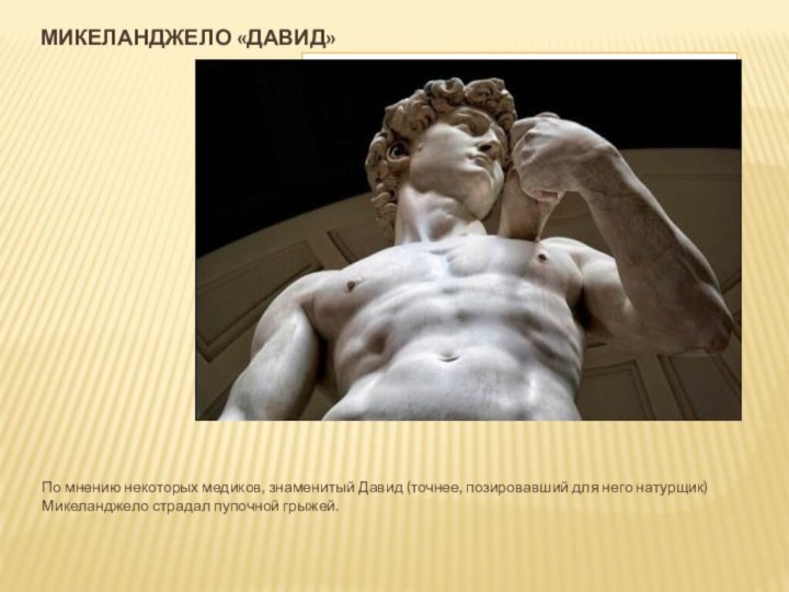 Микеланджело «давид» По мнению некоторых медиков, знаменитый Давид (точнее, позировавший для него
