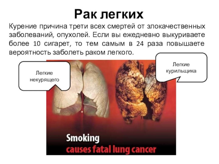 Рак легкихКурение причина трети всех смертей от злокачественных заболеваний, опухолей. Если вы