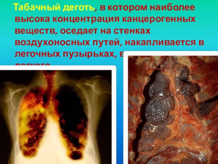 Табачный деготь, в котором наиболее высока концентрация канцерогенных веществ, оседает