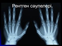 Рентген сәулелері (10 сынып)