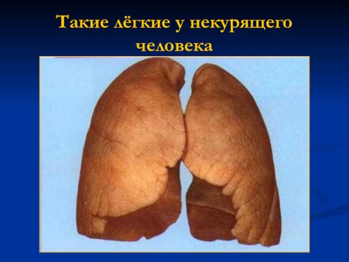 Такие лёгкие у некурящего человека
