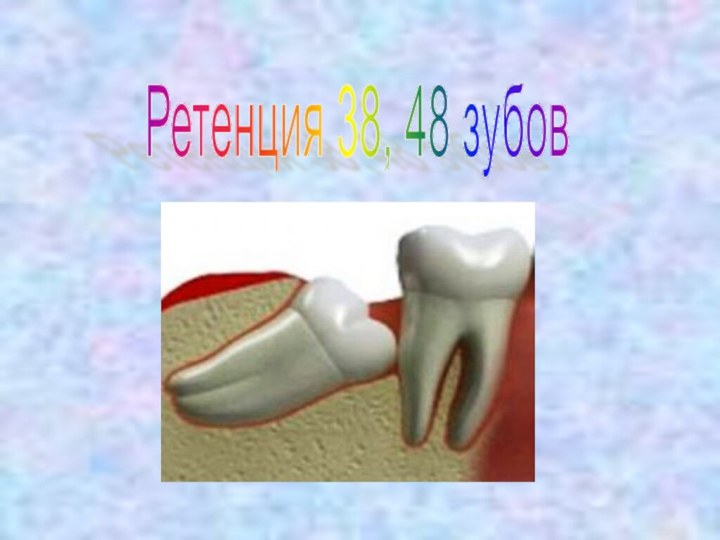 Ретенция 38, 48 зубов
